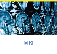 MRI Scan of the brain